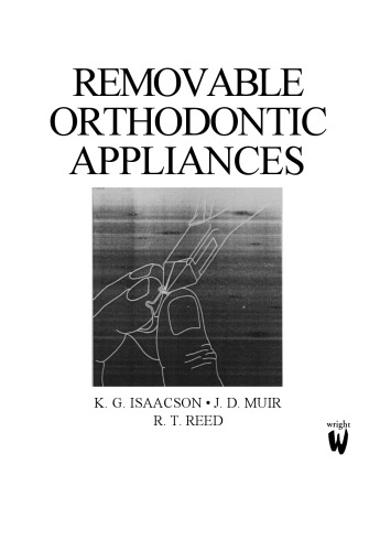 Removable Orthodontic Appliances