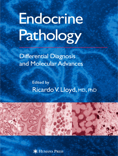 Endocrine Pathology: Differential Diagnosis and Molecular Advances