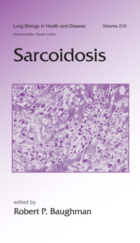 Lung Biology in Health & Disease Volume 210 Sarcoidosis