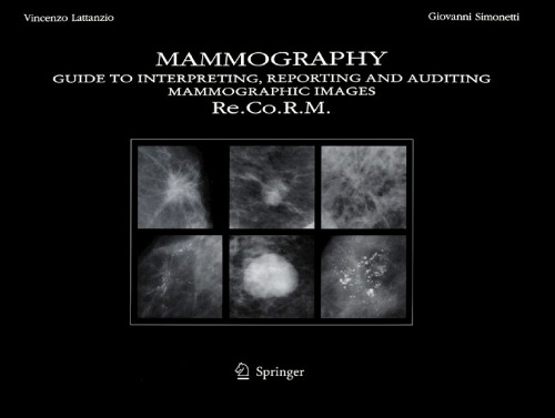 Mammography: Guide to Interpreting, Reporting and Auditing Mammographic Images - Re.Co.R.M. (From Italian Reporting and Codifying the Results of Mammography)