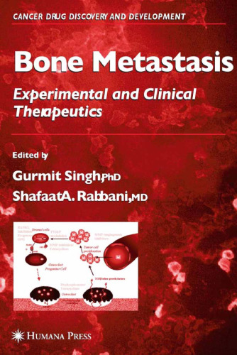 Bone Metastasis: Experimental and Clinical Therapeutics (Cancer Drug Discovery and Development)