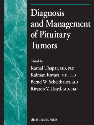 Diagnosis and Management of Pituitary Tumors