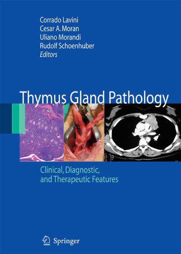 Thymus Gland Pathology: Clinical, Diagnostic and Therapeutic Features