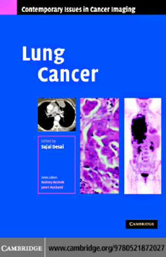 Lung Cancer (Contemporary Issues in Cancer Imaging)