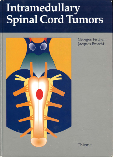 Intramedullary Spinal Cord Tumors