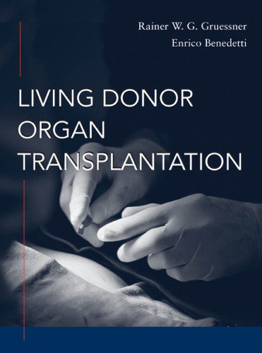 Living Donor Organ Transplantation