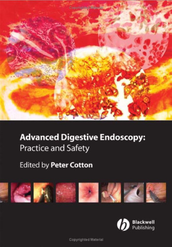 Advanced Digestive Endoscopy: Practice and Safety