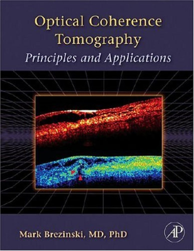 Optical Coherence Tomography: Principles and Applications