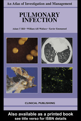 Pulmonary Infection: An Atlas of Investigation and Management