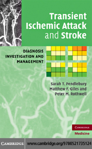 Transient Ischemic Attack and Stroke: Diagnosis, Investigation and Management