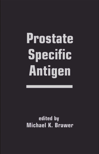 Prostate Specific Antigen