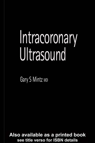 Intracoronary Ultrasound