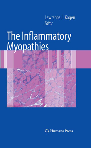 The Inflammatory Myopathies