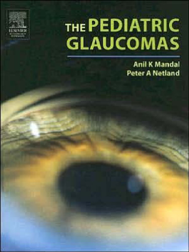 The Pediatric Glaucomas