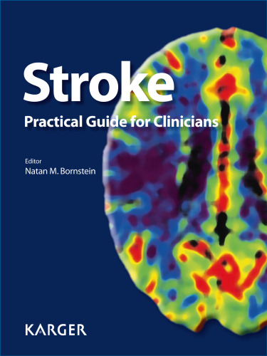 Stroke in Blacks: A Guide to Management and Prevention