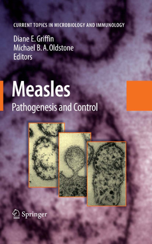 Measles: Pathogenesis and Control