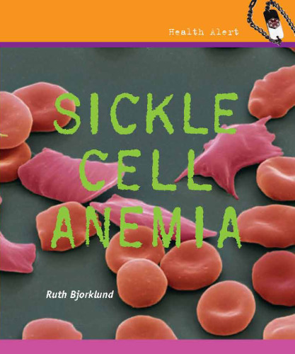 Sickle Cell Anemia