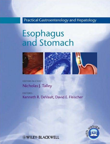 Practical Gastroenterology and Hepatology: Esophagus and Stomach