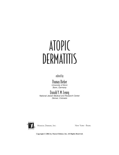 Atopic Dermatitis