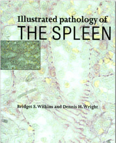 Illustrated Pathology of the Spleen