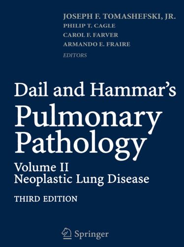 Dail and Hammar’s Pulmonary Pathology: Volume II: Neoplastic Lung Disease