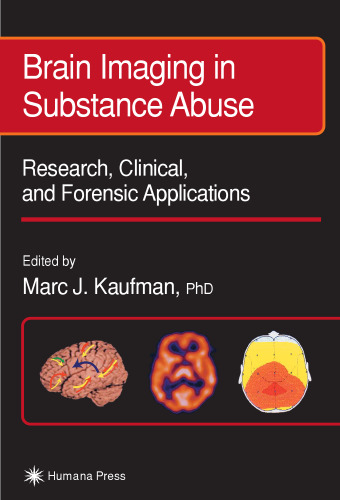 Brain Imaging in Substance Abuse: Research, Clinical, and Forensic Applications (Forensic Science and Medicine)