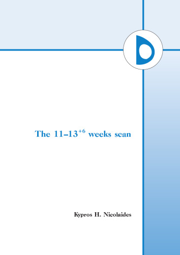 The 11-14-Week Scan: The Diagnosis of Fetal Abnormalities