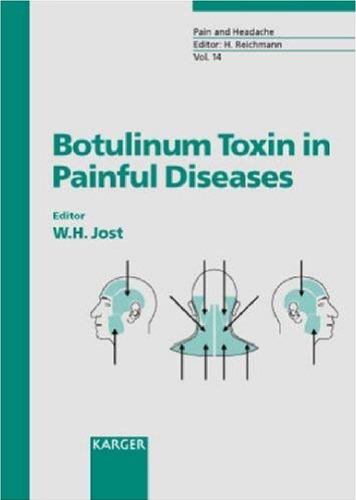 Botulinum Toxin in Painful Diseases (Pain and Headache)