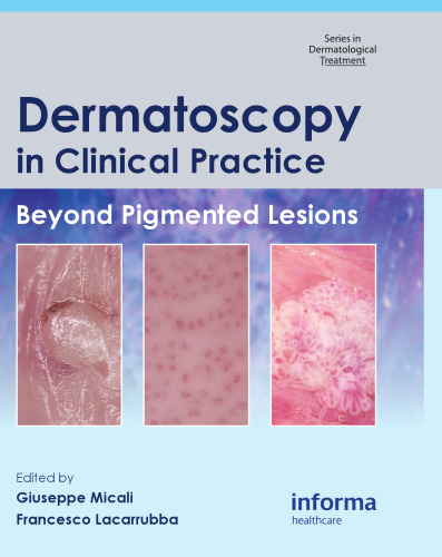 Dermatoscopy in Clinical Practice: Beyond Pigmented Lesions (Series in Dermatological Treatment)