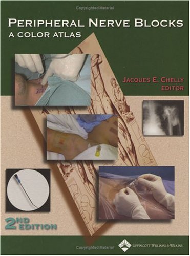 Peripheral Nerve Blocks: A Color Atlas