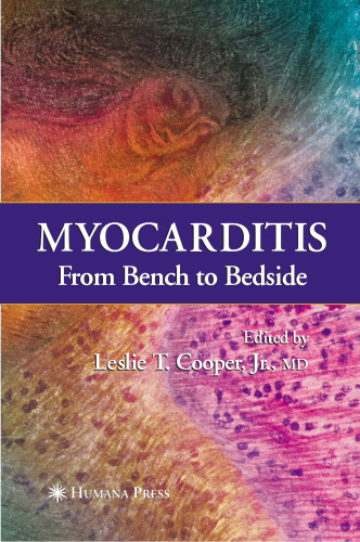 Myocarditis: From Bench to Bedside