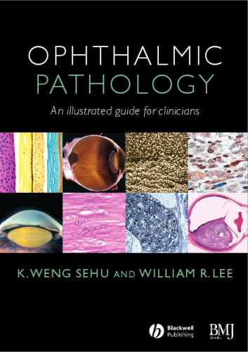 Ophthalmic Pathology: An Illustrated Guide for Clinicians