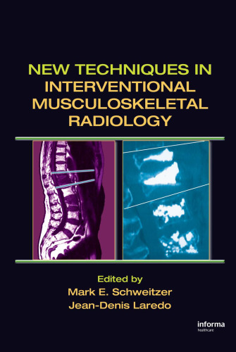 New Techniques in Interventional Musculoskeletal Radiology