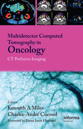 Multi-Detector Computed Tomography in Oncology: CT Perfusion Imaging