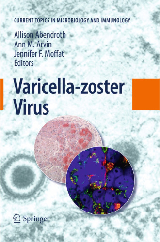 Varicella-zoster Virus