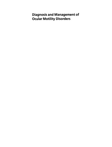 Diagnosis and Management of Ocular Motility Disorders