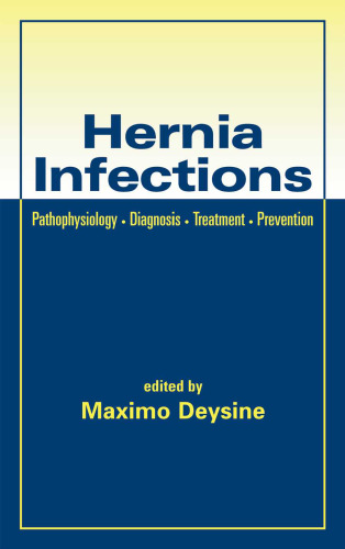 Hernia Infections: Pathophysiology - Diagnosis - Treatment - Prevention