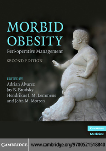 Morbid Obesity: Peri-operative Management, Second Edition