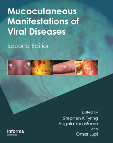 Mucocutaneous Manifestations of Viral Diseases: An Illustrated Guide to Diagnosis and Management, Second Edition