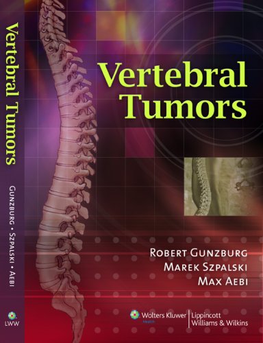 Vertebral Tumors