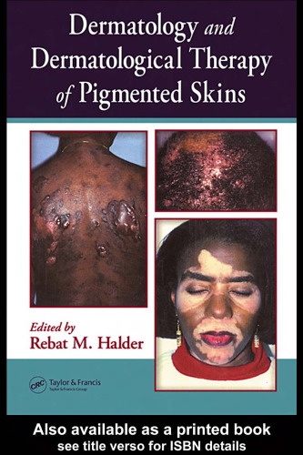 Dermatology and Dermatological Therapy of Pigmented Skins