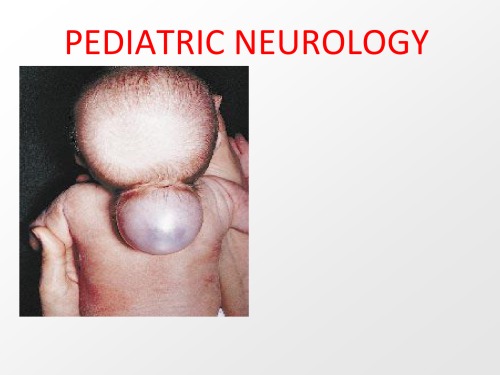 pediatric neurology