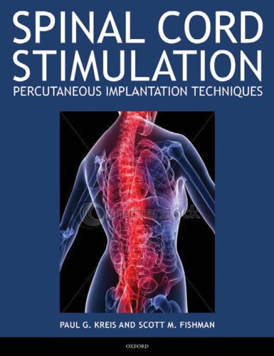 Spinal Cord Stimulation Implantation: Percutaneous Implantation Techniques