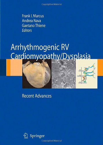 Arrhythmogenic right ventricular cardiomyopathy dysplasia: Recent Advances