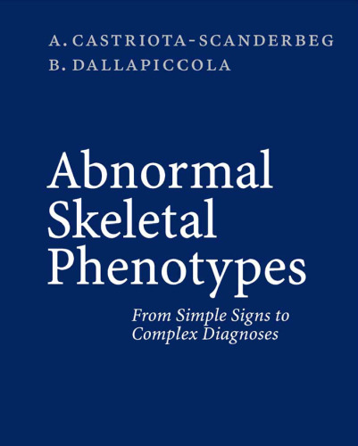 Abnormal Skeletal Phenotypes: From Simple Signs to Complex Diagnoses