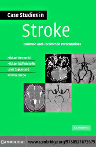 Case Studies in Stroke: Common and Uncommon Presentations (Case Studies in Neurology)