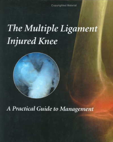 The Multiple Ligament Injured Knee: A Practical Guide to Management