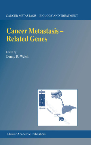 Cancer Metastasis -- Related Genes (CANCER METASTASIS -- BIOLOGY AND TREATMENT Volume 3) (Cancer Metastasis - Biology and Treatment)