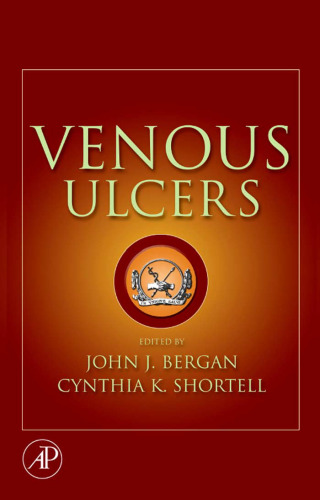 Venous Ulcers