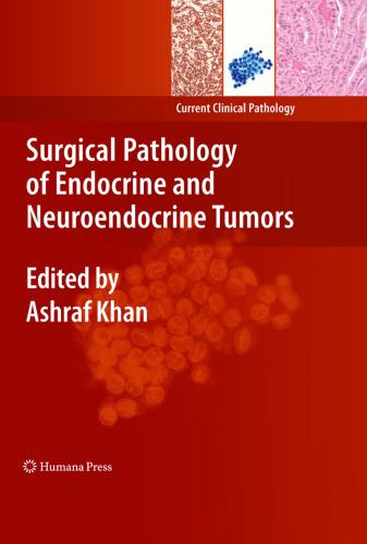 Surgical Pathology of Endocrine and Neuroendocrine Tumors